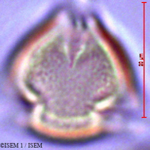 ISEM 1/Sophora_microcarpa_28569/Sophora_microcarpa_28569_0001(copy)_thumb.jpg